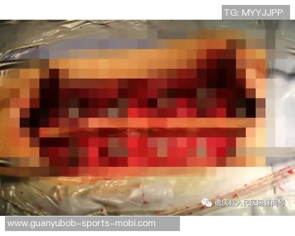 弗兰克透露比尔骨折如同车祸这并非常见篮球伤病